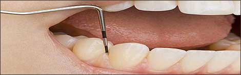 zahnarztangst therapie bayern